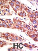 Anti-USP12 Rabbit Polyclonal Antibody (PE (Phycoerythrin))