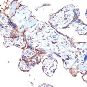 Immunohistochemistry analysis of paraffin-embedded human placenta using Anti-ARTS1/ERAP1 Antibody [ARC2120] (A308078) at a dilution of 1:100 (40x lens) Perform microwave antigen retrieval with 10 mM Tris/EDTA buffer pH 90 before commencing with IHC staining protocol