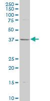 Anti-CDK7 Mouse Polyclonal Antibody