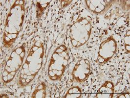 Anti-IKBKAP Mouse Monoclonal Antibody [clone: 6G9]