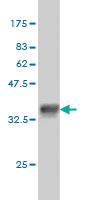 Anti-QARS Mouse Monoclonal Antibody [clone: 5F5]