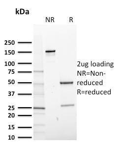 SDS-PAGE analysis of Anti-CD14 Antibody [LPSR/2408] under non-reduced and reduced conditions; showing intact IgG and intact heavy and light chains, respectively. SDS-PAGE analysis confirms the integrity and purity of the antibody