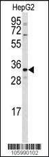 Anti-CTDSP2 Rabbit Polyclonal Antibody