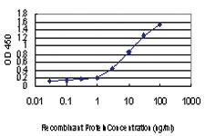 Anti-IKBKAP Mouse Monoclonal Antibody [clone: 6G9]