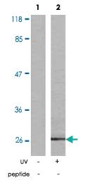 Anti-HSPB1 Rabbit Polyclonal Antibody