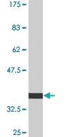 Anti-RING1 Mouse Monoclonal Antibody [clone: 2B3]