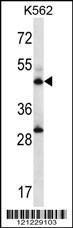 Anti-ADSS Rabbit Polyclonal Antibody (APC (Allophycocyanin))