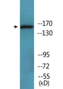 Western blot analysis of lysates from Jurkat cells using Anti-MAP3K1 (phospho Thr1402) Antibody