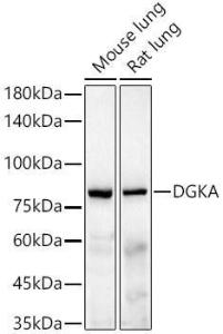 Western blot analysis of various lysates, using Anti-DGKA Antibody [ARC55777] (A306917) at 1:2,000 dilution The secondary antibody was Goat Anti-Rabbit IgG H&L Antibody (HRP) at 1:10,000 dilution Lysates/proteins were present at 25 µg per lane