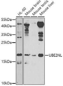 Western blot analysis of extracts of various cell lines, using Anti-UBE2NL Antibody (A8381) at 1:1,000 dilution