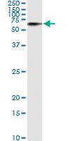 Anti-STK33 Mouse Monoclonal Antibody [clone: 6G1]