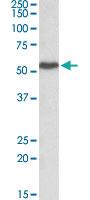 Anti-LSP1 Goat Polyclonal Antibody