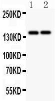 Anti-Collagen III Polyclonal Antibody