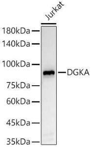 Western blot analysis of Jurkat, using Anti-DGKA Antibody [ARC55777] (A306917) at 1:2,000 dilution The secondary antibody was Goat Anti-Rabbit IgG H&L Antibody (HRP) at 1:10,000 dilution Lysates/proteins were present at 25 µg per lane