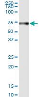 Anti-HRG Polyclonal Antibody Pair