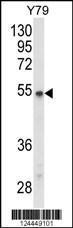 Anti-P2R3C Rabbit Polyclonal Antibody (PE (Phycoerythrin))