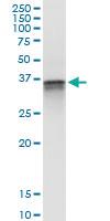 Anti-F11R Polyclonal Antibody Pair