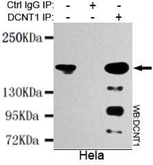 Anti-DCTN1 Mouse Monoclonal Antibody [clone: 13k48]