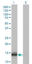 Anti-IFITM1 Mouse Monoclonal Antibody [clone: 1F8]