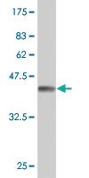 Anti-TPT1 Mouse Monoclonal Antibody [clone: 2C4]