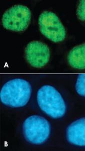 Anti-Histone H3 (K4me3) Rabbit Polyclonal Antibody