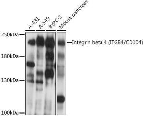 Western blot analysis of extracts of various cell lines, using Anti-Integrin beta 4 Antibody (A308080) at 1:1,000 dilution. The secondary antibody was Goat Anti-Rabbit IgG H&L Antibody (HRP) at 1:10,000 dilution.