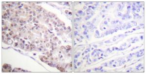 Antibody anti-HISTONE H4 ACETYL LYS8