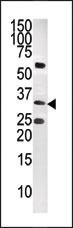 Anti-CTDSP1-V250 Rabbit Polyclonal Antibody