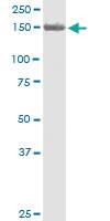 Anti-PKD2 Mouse Monoclonal Antibody [clone: 4C8]