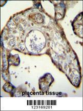 Anti-MNDA Rabbit Polyclonal Antibody (HRP (Horseradish Peroxidase))