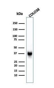 Western blot analysis of COLO-38 cell lysate using Anti-Melanoma gp100 Antibody [SPM142]