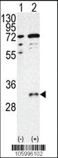 Anti-CTDSP1-V250 Rabbit Polyclonal Antibody