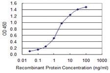 Anti-ATP2A1 Mouse Monoclonal Antibody [clone: 5G4]