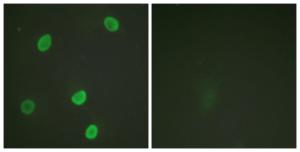 Antibody anti-HISTONE H4 ACETYL LYS8