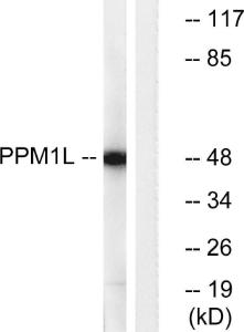 Western blot analysis of lysates from Jurkat cells using Anti-PPM1L Antibody. The right hand lane represents a negative control, where the antibody is blocked by the immunising peptide