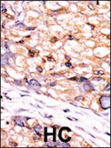 Anti-CTDSP1-V250 Rabbit Polyclonal Antibody