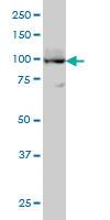 Anti-ATP2A3 Mouse Monoclonal Antibody [clone: 2H3]