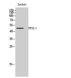 Western blot analysis of Jurkat cells using Anti-PPM1L Antibody