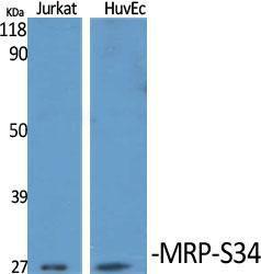 Anti-MRPS34 antibody