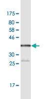 Anti-TPT1 Mouse Monoclonal Antibody [clone: 2A3]