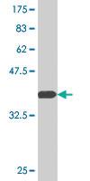 Anti-RING1 Mouse Monoclonal Antibody [clone: 2A6]