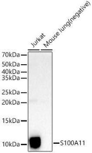 Western blot analysis of extracts of various cell lines, using Anti-S100A11 Antibody (A306920) at 1:400 dilution