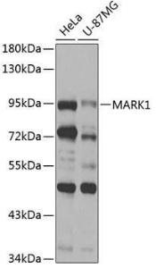 Western blot analysis of extracts of various cell lines, using Anti-MARK1 Antibody (A12254) at 1:1,000 dilution