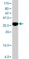 Anti-LAMTOR5 Mouse Polyclonal Antibody