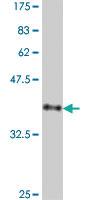 Anti-IL1RL2 Mouse Polyclonal Antibody