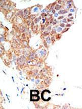 Anti-PRMT5 Rabbit Polyclonal Antibody (Biotin)