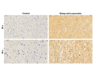 Analysis of ?-synuclein expression (brown) in formalin-fixed paraffin-embedded (FFPE) human Substantia Nigra tissue by Immunohistochemistry (IHC). Primary antibody: 4 µg/ml. Antigen retrieval: citrate buffer, pH 6, for 20 minutes. Blue: Cell nuclei (Hematoxylin nuclear counterstain).