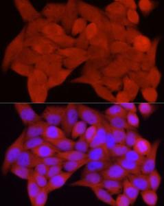 Immunofluorescence analysis of HeLa cells using Anti-S100A11 Antibody (A306920) at a dilution of 1:50 (40x lens). DAPI was used to stain the cell nuclei (blue)