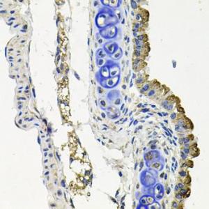 Immunohistochemistry analysis of paraffin-embedded mouse lung using Anti-MARK1 Antibody (A12254) at a dilution of 1:100 (40X lens). Perform microwave antigen retrieval with 10 mM PBS buffer pH 7.2 before commencing with IHC staining protocol