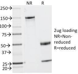 Anti-CD2 Mouse Monoclonal Antibody [clone: UMCD2]